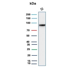 Western blot testing of human small intestine tissue lysate with recombinant Cadherin 17 antibody. Predicted molecular weight ~92 kDa but may be observed at higher molecular weights due to glycosylation.