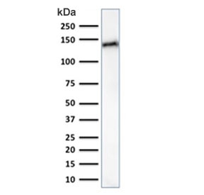 CDH17 Antibody WB. Western blot analysis of human small intestine lysate using CDH17 Antibody / Liver-Intestine Cadherin Antibody (clone CDH17/2617) demonstrates a strong immunoreactive band at approximately 130-140 kDa, consistent with expression of CDH17. Cadherin 17 (CDH17), also known as Liver-Intestine Cadherin (LI-cadherin), is a calcium-dependent cell adhesion molecule predominantly expressed in gastrointestinal epithelial cells, where it contributes to epithelial organization, maintenance of tissue integrity, and regulation of cell-cell interactions. The observed molecular weight is higher than the predicted size of approximately 92 kDa, a finding commonly attributed to extensive glycosylation of CDH17. These post-translational modifications frequently result in slower electrophoretic migration and increased apparent molecular weight during western blot analysis. Predicted molecular weight: approximately 92 kDa.