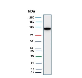 Cadherin 17 Antibody WB. Western blot analysis of human small intestine tissue lysate using Cadherin 17 Antibody / Epithelial Cell Adhesion Protein Antibody demonstrates a strong immunoreactive band at approximately 92-100 kDa, consistent with expression of CDH17. Cadherin 17 is a calcium-dependent cell adhesion molecule predominantly expressed in gastrointestinal epithelial cells, where it contributes to epithelial organization, tissue integrity, and maintenance of cell-cell interactions. CDH17 is widely used as a marker of intestinal epithelial differentiation and gastrointestinal lineage. The observed molecular weight is consistent with the heavily glycosylated nature of Cadherin 17, which may result in migration at higher apparent molecular weights than predicted. Predicted molecular weight: approximately 92 kDa.