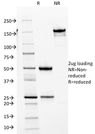 SDS-PAGE analysis of purified, BSA-free CDK2 antibody (clone AN21.2) as confirmation of integrity and purity.