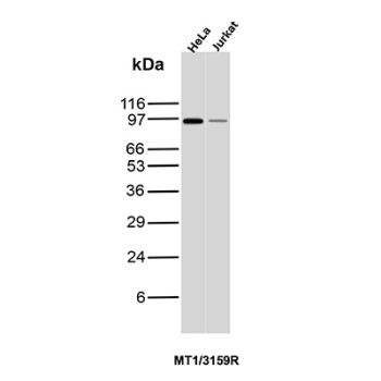 MALT1 Antibody WB HeLa Jurkat. Western blot analysis of Mucosa associated lymphoid tissue lymphoma translocation protein 1 / MALT1 expression in human HeLa and Jurkat cell lysates using MALT1 antibody clone MT1/3159R. A band is detected at approximately the expected molecular weight for MALT1 in both cell lines, consistent with expression of the full-length protein, with signal intensity reflecting relative expression levels between samples.
