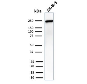 Western blot testing of human SK-BR-3 cells with CHD4 antibody. Predicted molecular weight ~218 kDa, commonly observed at 240-260 kDa.