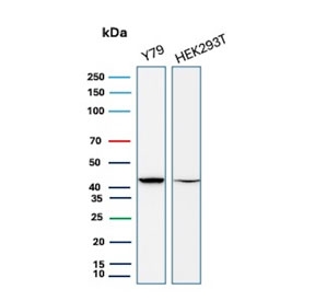 CKB Antibody for WB Y79 and HEK293. Western blot testing of human Y79 and HEK293 cell lysate with CKB antibody (clone CPTC-CKB-2). Predicted molecular weight ~43 kDa.