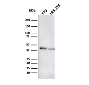 CKB Antibody for WB Y79 and HEK293 Cells. Western blot testing of human Y79 and HEK293 cell lysate with CKB antibody (clone CPTC-CKB-2). Predicted molecular weight ~43 kDa.