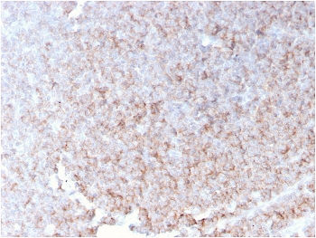 CD21 Antibody Spleen IHC. Immunohistochemistry staining of FFPE human spleen with recombinant CD21 antibody (clone rCR2/1952). HIER: boil tissue sections in pH 9 10mM Tris with 1mM EDTA for 10-20 min and allow to cool before testing.