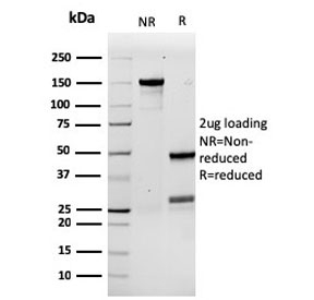 SDS-PAGE analysis of purified, BSA-free recombinant Granulocyte-Colony Stimulating Factor antibody (clone rCSF3/900) as confirmation of integrity and purity.