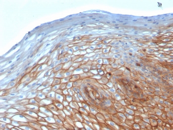 Drebrin Neuronal Actin-Binding Protein Antibody Cervical Epithelium IHC. Immunohistochemistry analysis of FFPE human cervix using Drebrin Antibody (clone DBN1/2880) shows prominent cytoplasmic and membranous staining in stratified epithelial cells, consistent with DBN1 / Drebrin localization associated with actin cytoskeletal organization. The staining highlights epithelial cell layers with defined cell borders, reflecting actin-associated structural support within the tissue. Hematoxylin counterstain provides nuclear contrast and architectural detail. HIER: boil FFPE tissue sections in pH 9 10 mM Tris with 1 mM EDTA for 10-20 min followed by cooling at RT for 20 min.
