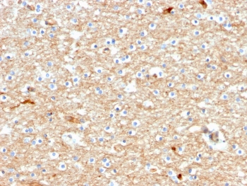Drebrin Neuronal Actin-Binding Protein Antibody Brain Tissue IHC. Immunohistochemistry analysis of FFPE human brain tissue using Drebrin Antibody (clone DBN1/2880) shows diffuse cytoplasmic staining in neuronal cells with enrichment in neuronal processes, consistent with DBN1 / Drebrin localization associated with actin cytoskeletal organization in synaptic structures. The staining pattern highlights neuronal architecture, while surrounding non-neuronal regions display comparatively lower signal. Hematoxylin counterstain provides nuclear contrast and tissue context. HIER: boil FFPE tissue sections in pH 9 10 mM Tris with 1 mM EDTA for 10-20 min followed by cooling at RT for 20 min.