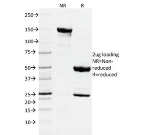 SDS-PAGE analysis of purified, BSA-free DNMT1 / DNA Methyltransferase 1 antibody as confirmation of integrity and purity.