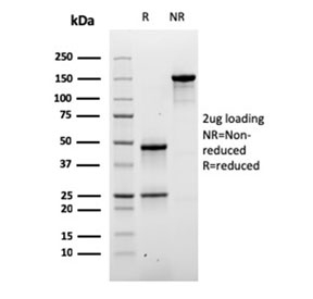 SDS-PAGE analysis of purified, BSA-free DSG3 antibody-microarray validated clone DSG3/2840 as confirmation of integrity and purity.