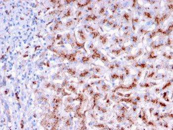 Cathepsin D Lysosomal Protease Antibody Liver Tissue IHC. Immunohistochemistry analysis of FFPE human liver tissue using Cathepsin D Antibody (clone CTSD/3276) shows granular cytoplasmic staining in hepatocytes, consistent with CTSD localization in lysosomal compartments. The punctate pattern reflects lysosomal protease activity associated with intracellular protein processing and turnover. Hepatic architecture is well preserved, and non-parenchymal regions display comparatively lower staining. Hematoxylin counterstain provides nuclear contrast and structural context. HIER: boil FFPE tissue sections in pH 9 10 mM Tris with 1 mM EDTA for 10-20 min and allow to cool before testing.