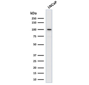 Folate Hydrolase 1 Antibody LNCaP WB. Western blot analysis of human LNCaP cell lysate using Folate Hydrolase 1 Antibody / Folate Metabolism Marker. A strong band is detected at approximately 100 kDa, consistent with the predicted molecular weight of Folate hydrolase 1 / FOLH1, also known as Prostate-specific membrane antigen / PSMA. The observed signal is consistent with established FOLH1 expression in prostate-derived tumor cell models and supports its role as a membrane-associated metallopeptidase involved in folate metabolism and prostate cancer-associated signaling pathways.