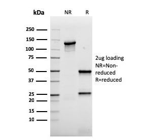 SDS-PAGE analysis of purified, BSA-free recombinant AKT1 antibody (clone rAKT1/2491) as confirmation of integrity and purity.