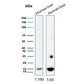 CSF3 Antibody Human Liver WB. Western blot analysis of Granulocyte colony stimulating factor / CSF3 in human liver tissue lysates using rabbit monoclonal CSF3 antibody, clone CSF3/3166R. Two lanes are shown at different antibody dilutions (1:100 and 1:50), with bands detected at approximately 18-20 kDa, consistent with the predicted molecular weight of G-CSF, supporting detection of this hematopoietic cytokine in liver tissue.