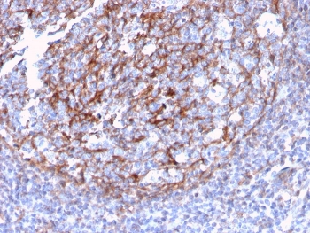 CD21 Antibody Germinal Network IHC. Immunohistochemistry of Complement Receptor 2 / CD21 in FFPE human tonsil tissue using recombinant rabbit monoclonal CD21 antibody, clone CR2/3124R. HRP-DAB brown staining highlights a reticular follicular dendritic cell network within germinal center regions, with associated membranous staining of B lymphocytes, while surrounding lymphoid cells show minimal staining and nuclei are counterstained blue. Heat induced epitope retrieval was performed by boiling tissue sections in pH 9 10 mM Tris with 1 mM EDTA for 10-20 min followed by cooling prior to staining.