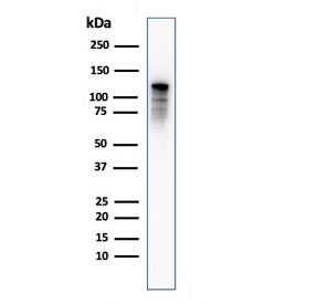 Drebrin 1 Antibody WB. Western blot testing of human PC3 cell lysate with Drebrin 1 antibody (clone DBN1/2879). Expected molecular weight: 70-120 kDa.