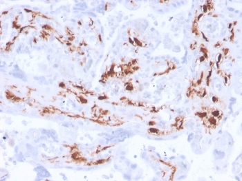 Immunohistochemistry of F13A1 antibody in human placenta. FFPE human placental tissue was stained with F13A1 antibody recombinant rabbit mAb F13A1/3772R. Distinct cytoplasmic HRP-DAB brown staining is observed in stromal and intervillous macrophage-lineage cells within chorionic villi, consistent with known Factor XIII A chain expression in placental macrophages. Surrounding trophoblastic and endothelial cells show minimal to absent staining. Heat induced epitope retrieval was performed by boiling tissue sections in pH 9 Tris-EDTA buffer for 20 minutes followed by cooling prior to antibody incubation.