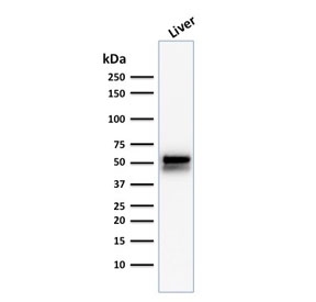 ALDH1A1 Antibody Liver WB. Western blot analysis of human liver lysate using ALDH1A1 Antibody / Gastric and Hepatic Detoxification Marker clone ALDH1A1/1381. A strong band is detected at approximately 55 kDa, consistent with the predicted molecular weight of Aldehyde dehydrogenase 1 family member A1 / ALDH1A1. The prominent hepatic signal aligns with the established role of ALDH1A1 in aldehyde detoxification, retinoic acid biosynthesis, and intermediary metabolic pathways within hepatocytes.