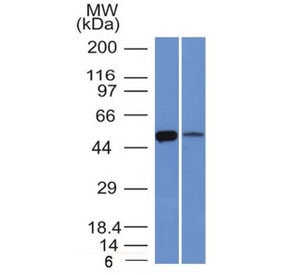 ALDH1A1 Antibody K562 and Lung WB. Western blot testing of human K562 (left) and lung (right) lysate with ALDH1A1 antibody (clone ALDH1A1/1381). Expected molecular weight ~55 kDa.