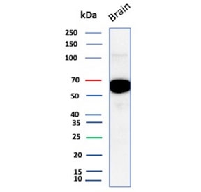 ALDH1A1 Antibody Brain WB. Western blot testing of human brain tissue lysate with ALDH1A1 antibody (clone ALDH1A1/1381). Expected molecular weight ~55 kDa.