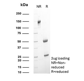 SDS-PAGE analysis of purified, BSA-free CD64 antibody (clone 10.1) as confirmation of integrity and purity.