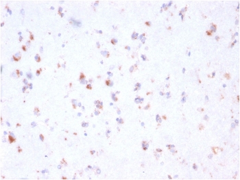 FCGRT Antibody Cerebellum IHC. Immunohistochemistry analysis of FFPE human cerebellum tissue stained with FCGRT Antibody / Neonatal Fc Receptor clone FCGRT/2932 following HIER in pH 9 Tris-EDTA buffer. Distinct HRP-DAB brown staining is observed in scattered neural-associated cell populations, consistent with expression of FcRn/FCGRT, a receptor involved in IgG transport, albumin recycling, and Fc-mediated barrier transport biology within neural tissues.