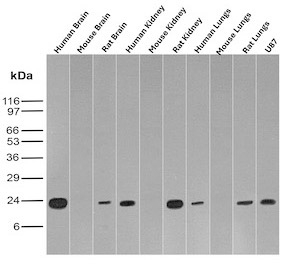 FTH1 Antibody Multi-Tissue WB. Western blot analysis of human, mouse, and rat brain, kidney, and lung lysates together with human U87 cell lysate using monoclonal clone FTH/2081 demonstrates distinct bands near 20-24 kDa, consistent with the expected molecular weight of Ferritin heavy chain 1 / FTH1. The broad cross-species expression pattern supports the established role of FTH1 as a conserved intracellular iron storage protein involved in iron homeostasis, oxidative stress regulation, and cellular metabolic balance across multiple tissue types.