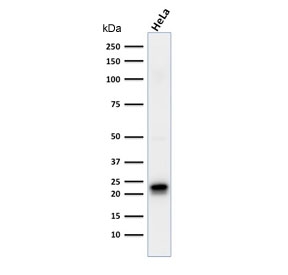 Western blot testing of human HeLa cell lysate with FTH1 antibody (clone FTH/2081). Predicted molecular weight ~21 kDa.