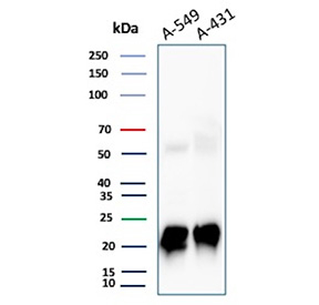 FTH1 Antibody Lung Carcinoma WB. Western blot analysis of human A-549 and A-431 cell lysates using FTH1 Antibody FTH/2081 demonstrates strong bands near 20-24 kDa corresponding to Ferritin heavy chain 1 / FTH1, with additional faint higher molecular weight signal likely representing ferritin-associated multimeric or incompletely denatured protein species. The observed expression profile supports the established role of FTH1 in intracellular iron sequestration, oxidative stress protection, and metabolic adaptation within epithelial carcinoma-derived cell lines.