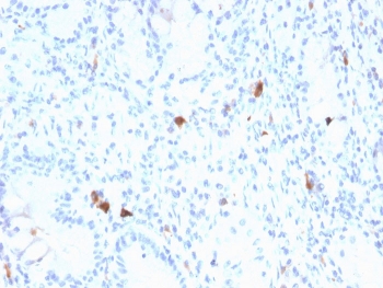 Gastrin Antibody Stomach IHC. Immunohistochemistry analysis of FFPE human stomach tissue stained with Gastrin Antibody demonstrates sparse cytoplasmic HRP-DAB brown staining within scattered gastrointestinal endocrine-associated cellular populations distributed throughout gastric glandular structures. This gastrointestinal hormone marker antibody highlights Gastrin / GAST-expressing neuroendocrine cells involved in gastric acid regulatory signaling and digestive peptide hormone-associated pathways. HIER: boil tissue sections in pH 9 10mM Tris with 1mM EDTA for 20 min and allow to cool before testing.