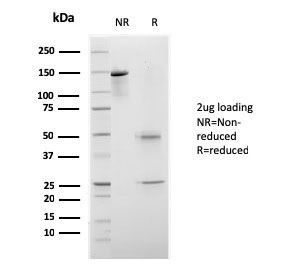 SDS-PAGE analysis of purified, BSA-free recombinant mouse monoclonal CELA3B antibody (clone rCELA3B/1811) as confirmation of integrity and purity.