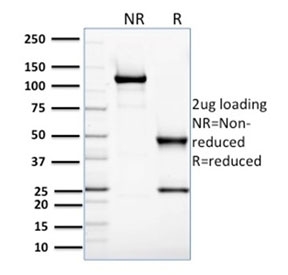 SDS-PAGE analysis of purified, BSA-free Glyoxalase 1 antibody (clone CPTC-GLO1-3) as confirmation of integrity and purity.