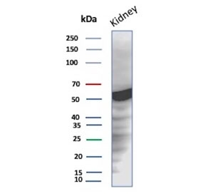 Western blot testing of human kidney tissue lysate with Glucose 6-Phosphate Isomerase antibody. Predicted molecular weight: ~63 kDa.