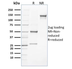 CLEC9A Antibody SDS-PAGE Analysis. SDS-PAGE analysis of purified, BSA-free CLEC9A Antibody clone 8F9 demonstrates the expected antibody migration pattern under reducing (R) and non-reducing (NR) conditions. Under reducing conditions, distinct bands corresponding to the immunoglobulin heavy and light chains are observed at approximately 50 kDa and 25 kDa, respectively. Under non-reducing conditions, the antibody migrates predominantly as an intact immunoglobulin species at approximately 150 kDa. These results confirm the integrity and purity of clone 8F9 and support its use for research applications targeting CLEC9A / DNGR-1, a C-type lectin receptor expressed by specialized dendritic cell populations involved in antigen presentation, dead-cell sensing, and immune regulation.