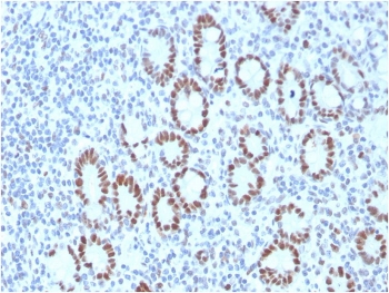 IHC staining of FFPE human small intestine with MSH6 antibody (clone MSH6/3089). HIER: boil tissue sections in pH 9 10mM Tris with 1mM EDTA for 10-20 min and allow to cool before testing.