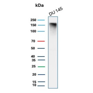 Western blot testing of human DU 145 lysate with MSH6 antibody (clone MSH6/3089). Expected molecular weight: 120-160 kDa depending on phosphorylation level.