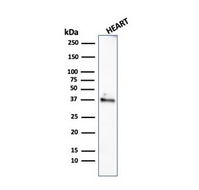 Western blot testing of human heart lysate with recombinant Histone H1 antibody (clone rAE-4). Predicted molecular weight ~20 kDa but can be observed at 27-33 kDa.
