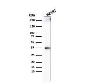 Histone H1 Antibody for WB. Western blot analysis of replication-associated histone H1 expression in human heart tissue lysate. A band is detected at approximately 27-33 kDa, compared to the predicted molecular weight of Histone H1 family proteins at approximately 20 kDa. The higher apparent molecular weight is consistent with post-translational modifications such as phosphorylation, which can alter electrophoretic mobility of linker histone H1 during replication-coupled chromatin assembly. The recombinant rabbit clone AE-4 antibody demonstrates detection of modified histone H1 species associated with chromatin reorganization.