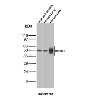 CD209 Antibody in Human Intestine, Lung and Liver WB. Western blot testing of CD209 Antibody / C-Type Lectin Receptor Antibody clone rC209/1781 in human intestine, lung and liver tissue lysates. A prominent band is observed at approximately 50 kDa in intestine and lung, while liver shows a broader, more heterogeneous signal centered around ~50 kDa. The observed migration is consistent with the glycosylated nature of DC-SIGN/CD209, a C-type lectin receptor with a predicted molecular weight of approximately 46 kDa.