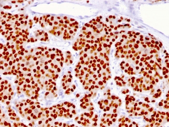 FOXA1 Antibody Human Prostate IHC. Immunohistochemical staining of FFPE human prostate tissue using FOXA1 Antibody (clone FOXA1/1516) demonstrates strong nuclear HRP-DAB brown staining throughout prostatic epithelial cell populations. The staining pattern is consistent with expression of FOXA1, a forkhead family transcription factor that functions as a developmental regulator of gene expression, epithelial differentiation, and tissue-specific transcriptional programs. The prominent nuclear localization is characteristic of a DNA-binding transcription factor and supports the role of FOXA1 in maintaining epithelial lineage identity and regulating gene networks associated with prostate development, differentiation, and tissue homeostasis. HIER: steam sections in pH 9 10 mM Tris with 1 mM EDTA for 10-20 minutes and allow to cool before testing.