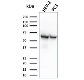 Western blot testing of human HEP-2 and PC3 cell lysate with HSP60 antibody (clone CPTC-HSPD1-1). Predicted molecular weight ~60 kDa.