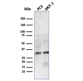 NKX2.8 Antibody WB. Western blot analysis of human PC-3 and MCF-7 cell lysates using NKX2.8 Antibody detects bands migrating between approximately 26-34 kDa, consistent with the predicted molecular weight of NKX2.8 and commonly observed migration patterns for homeobox-associated transcription factors. This homeobox transcription factor antibody highlights developmental regulatory signaling and lineage-associated transcriptional control pathways in epithelial-derived tumor cell lines.