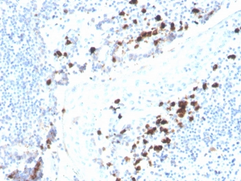 IHC IgA Heavy Chain Antibody Recombinant Mouse MAb rHISA43 in human tonsil. Immunohistochemistry analysis of IgA Heavy Chain Antibody Recombinant Mouse MAb rHISA43 in formalin-fixed paraffin-embedded human tonsil tissue. The recombinant mouse monoclonal antibody (clone rHISA43) shows cytoplasmic HRP-DAB brown staining in scattered plasma cells within the tonsillar lymphoid tissue, consistent with expression of Immunoglobulin alpha heavy chain (IGHA), the heavy chain component of IgA antibodies produced by differentiated B cells. Positive staining is primarily observed in plasma cells located within lymphoid regions, while surrounding lymphocytes remain largely negative. Antigen retrieval was performed by boiling tissue sections in pH 9 Tris-EDTA buffer (10mM Tris, 1mM EDTA) for 10-20 minutes followed by cooling prior to antibody incubation.