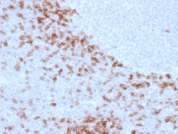 Human IgD Antibody Clone IgD26 immunohistochemistry analysis of human lymph node tissue. Formalin-fixed paraffin-embedded human lymph node tissue stained with Human IgD Antibody Clone IgD26 shows HRP-DAB brown chromogenic staining in B lymphocytes within lymphoid follicles. Positive cells are concentrated in mantle zone regions surrounding germinal centers and display membranous and cytoplasmic staining consistent with Immunoglobulin D expression in mature naive B lymphocytes. Heat induced epitope retrieval was performed by boiling tissue sections in pH 9 10mM Tris with 1mM EDTA for 10-20 minutes followed by cooling prior to antibody incubation.