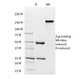 SDS-PAGE analysis of purified, BSA-free IgD antibody (clone IgD26) as confirmation of integrity and purity.