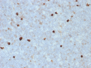 IgM Heavy Chain Antibody R1/69 Immunohistochemistry. IHC staining of FFPE human tonsil with Immunoglobulin M Heavy Chain Antibody (clone R1/69). HIER: boil tissue sections in pH 9 10mM Tris with 1mM EDTA for 10-20 min and allow to cool before testing.
