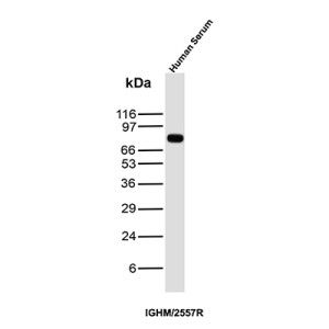 Recombinant IgM Antibody IGHM/2557R in Human Serum WB. Western blot testing of human serum with Recombinant IgM Antibody clone IGHM/2557R detects a strong, discrete band at approximately 75 kDa, consistent with the expected size of the immunoglobulin mu heavy chain. Minimal additional reactivity is visible under the tested conditions, producing a clean Western blot signal. This Recombinant Immunoglobulin M Antibody recognizes the heavy chain component of human IgM.