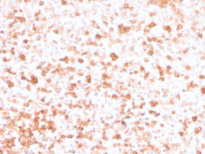 IHC staining of FFPE human tonsil with recombinant Lambda Light Chain antibody (clone rLLC/3777). HIER: boil tissue sections in pH 9 10mM Tris with 1mM EDTA for 20 min and allow to cool before testing.