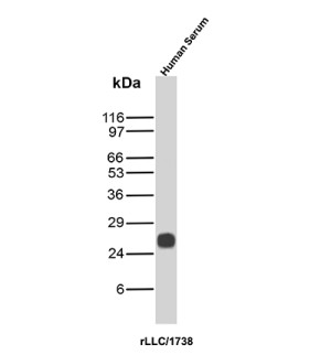 Lambda Light Chain Antibody rLLC/1738 in Human Serum WB. Western blot testing of human serum with Lambda Light Chain Antibody clone rLLC/1738 detects a strong, discrete band at approximately 25-27 kDa with minimal additional reactivity. The observed molecular weight is consistent with the expected migration of human immunoglobulin lambda light chain. The predominant signal demonstrates recognition by the IGL Antibody in human serum under the tested conditions.