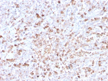IHC staining of FFPE human spleen with recombinant Lambda antibody (clone LLC/3778R). HIER: boil tissue sections in pH 9 10mM Tris with 1mM EDTA for 20 min and allow to cool before testing.